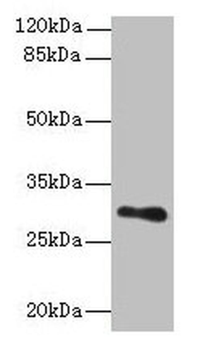 T176B Antibody in Western Blot (WB)