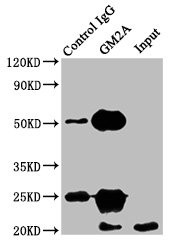 GM2A Antibody in Immunoprecipitation (IP)