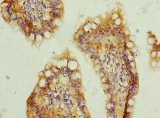 TMEM91 Antibody in Immunohistochemistry (Paraffin) (IHC (P))