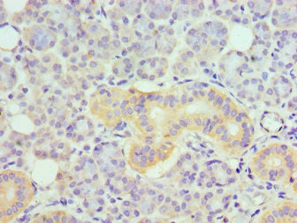 DR6 Antibody in Immunohistochemistry (Paraffin) (IHC (P))