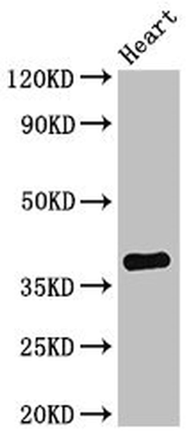 TNMD Antibody in Western Blot (WB)