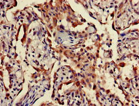 TPST1 Antibody in Immunohistochemistry (Paraffin) (IHC (P))