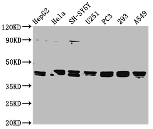 TPST1 Antibody in Western Blot (WB)