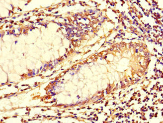 TUBG1 Antibody in Immunohistochemistry (Paraffin) (IHC (P))