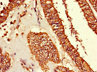 TUBG1 Antibody in Immunohistochemistry (Paraffin) (IHC (P))