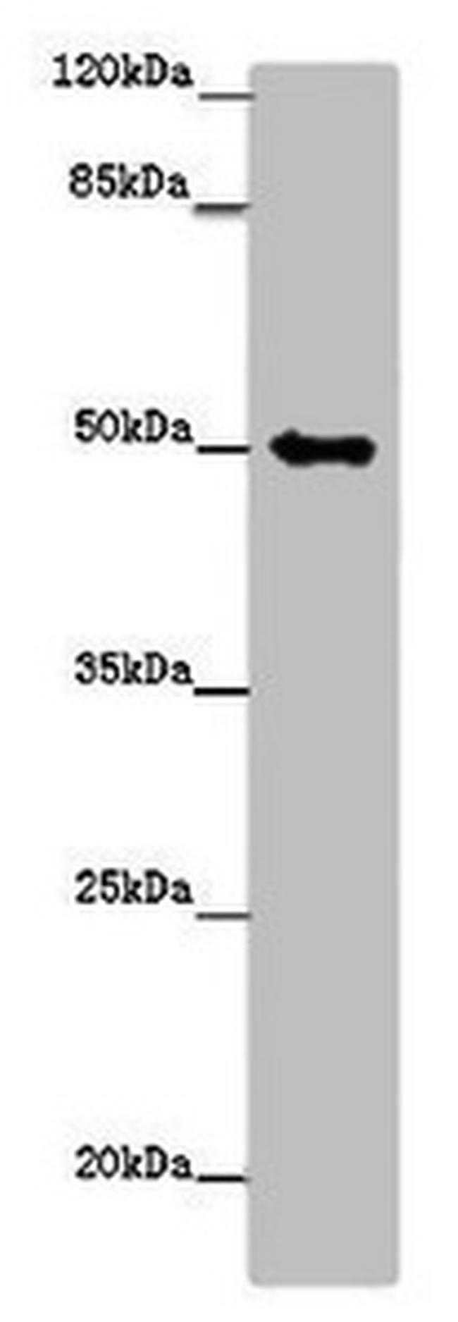 TUBG1 Antibody in Western Blot (WB)