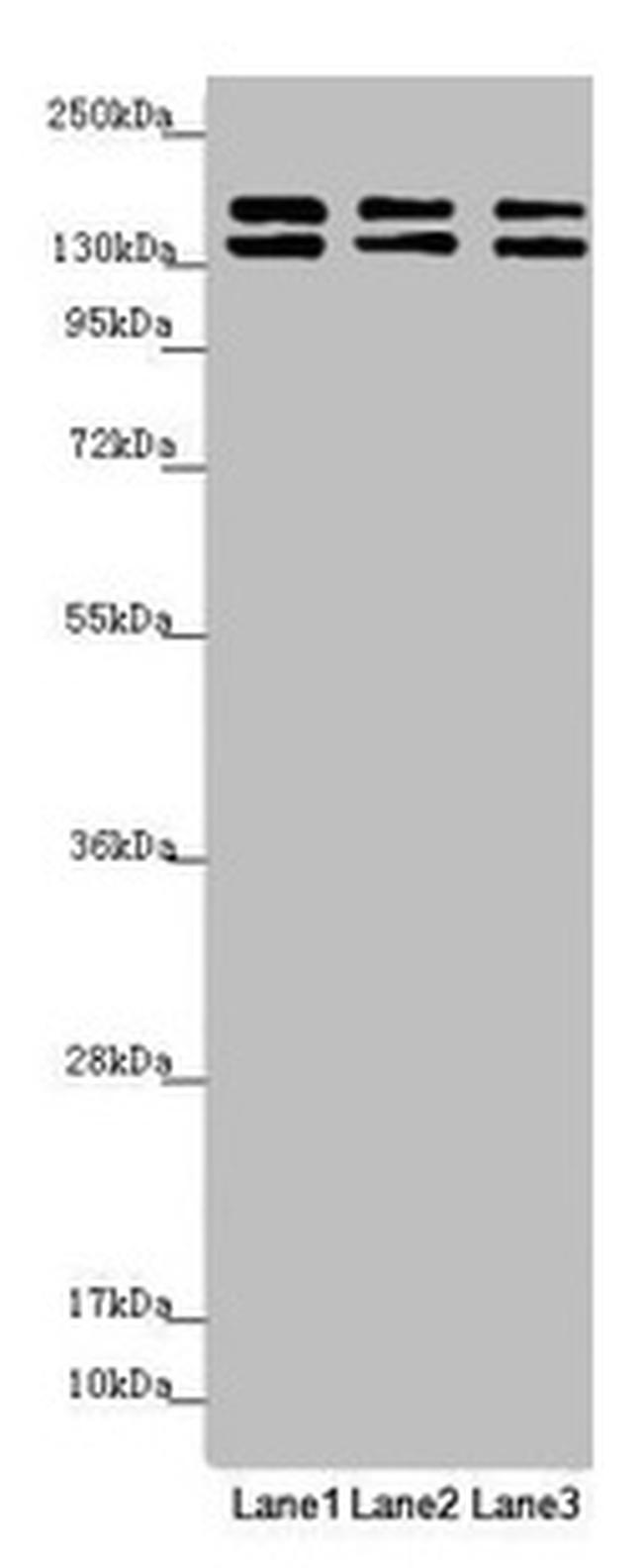 UACA Antibody in Western Blot (WB)