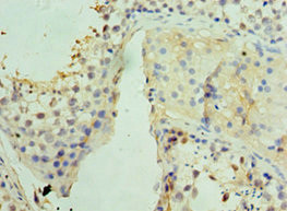 UCP1 Antibody in Immunohistochemistry (Paraffin) (IHC (P))