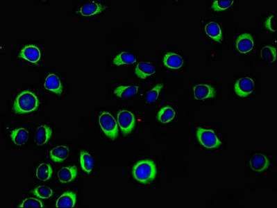 WISP1 Antibody in Immunocytochemistry (ICC/IF)