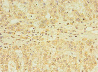 YKT6 Antibody in Immunohistochemistry (Paraffin) (IHC (P))