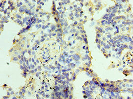 ZMYND10 Antibody in Immunohistochemistry (Paraffin) (IHC (P))