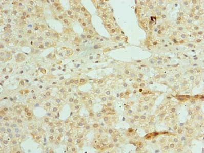 ZSCAN9 Antibody in Immunohistochemistry (Paraffin) (IHC (P))