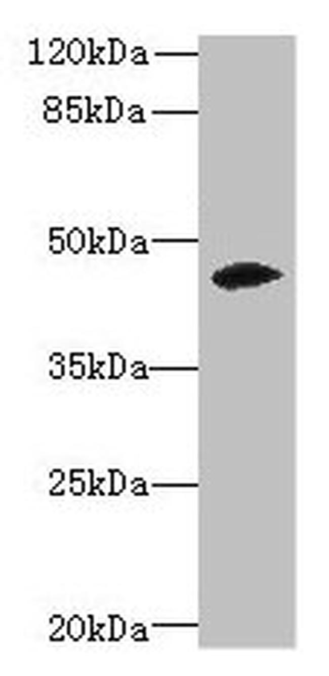 ZSCAN9 Antibody in Western Blot (WB)