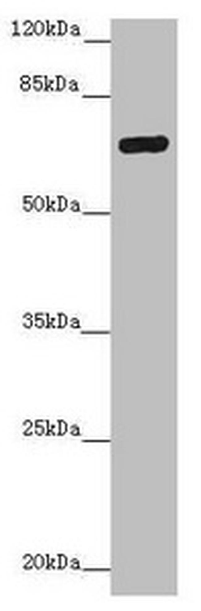 ZNF20 Antibody in Western Blot (WB)