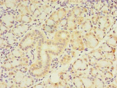 ZNF238 Antibody in Immunohistochemistry (Paraffin) (IHC (P))