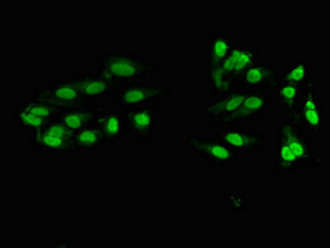 ZNF331 Antibody in Immunocytochemistry (ICC/IF)