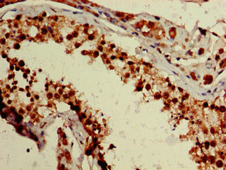 ZNF331 Antibody in Immunohistochemistry (Paraffin) (IHC (P))