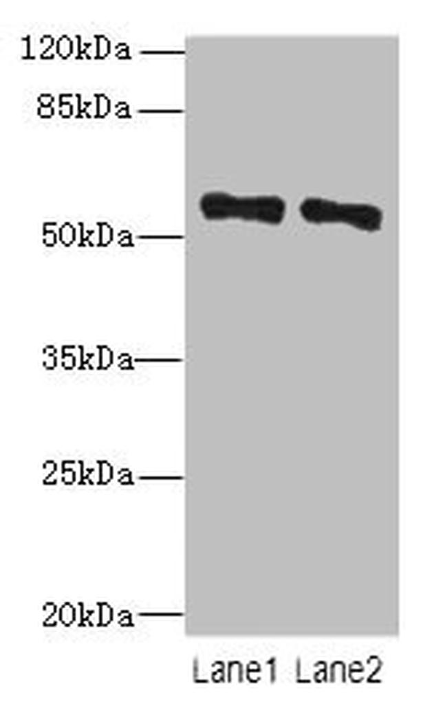 ZNF689 Antibody in Western Blot (WB)