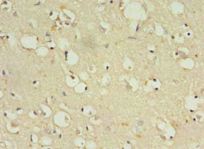 ZNF699 Antibody in Immunohistochemistry (Paraffin) (IHC (P))