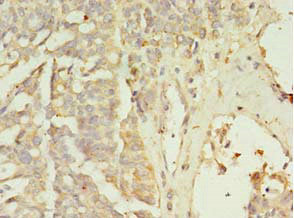 ZNF699 Antibody in Immunohistochemistry (Paraffin) (IHC (P))