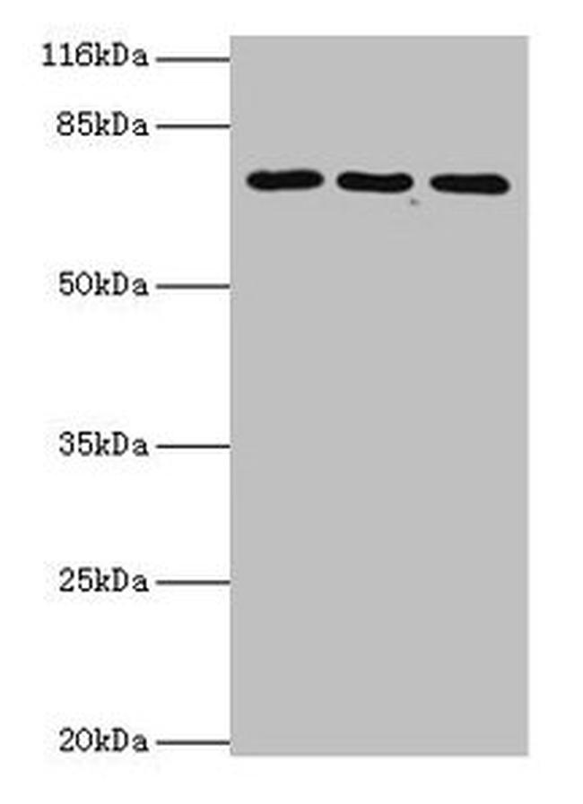 ZNF699 Antibody in Western Blot (WB)