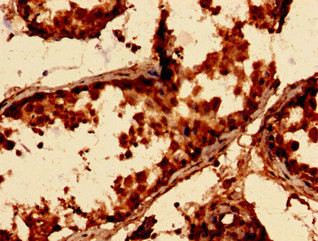 p21 ARC Antibody in Immunohistochemistry (Paraffin) (IHC (P))