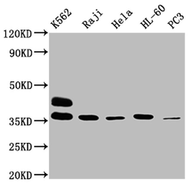 FCGR2A Antibody in Western Blot (WB)