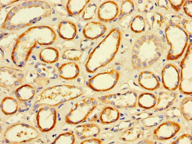 FCGR2A Antibody in Immunohistochemistry (Paraffin) (IHC (P))