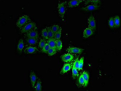 SCAMP3 Antibody in Immunocytochemistry (ICC/IF)