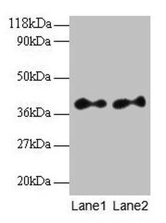 SCAMP3 Antibody in Western Blot (WB)