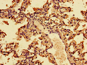 Interferon alpha-2 Antibody in Immunohistochemistry (Paraffin) (IHC (P))