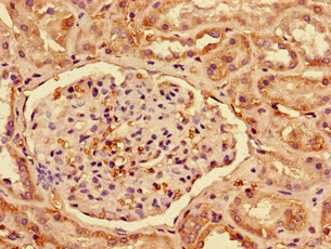 Interferon alpha-2 Antibody in Immunohistochemistry (Paraffin) (IHC (P))