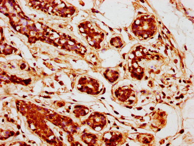 TGF beta-2 Antibody in Immunohistochemistry (Paraffin) (IHC (P))