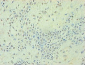 TGF beta-2 Antibody in Immunohistochemistry (Paraffin) (IHC (P))