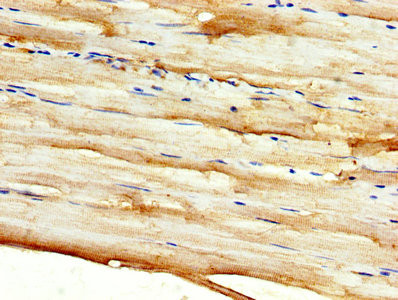 DKK2 Antibody in Immunohistochemistry (Paraffin) (IHC (P))