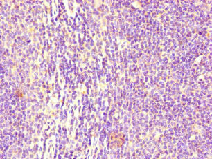 FCGR2B Antibody in Immunohistochemistry (Paraffin) (IHC (P))