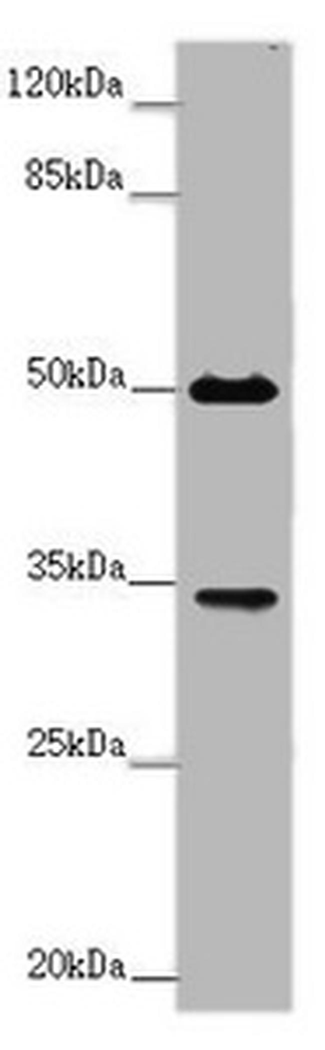 FCGR2B Antibody in Western Blot (WB)