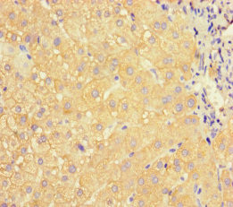 ApoC3 Antibody in Immunohistochemistry (Paraffin) (IHC (P))