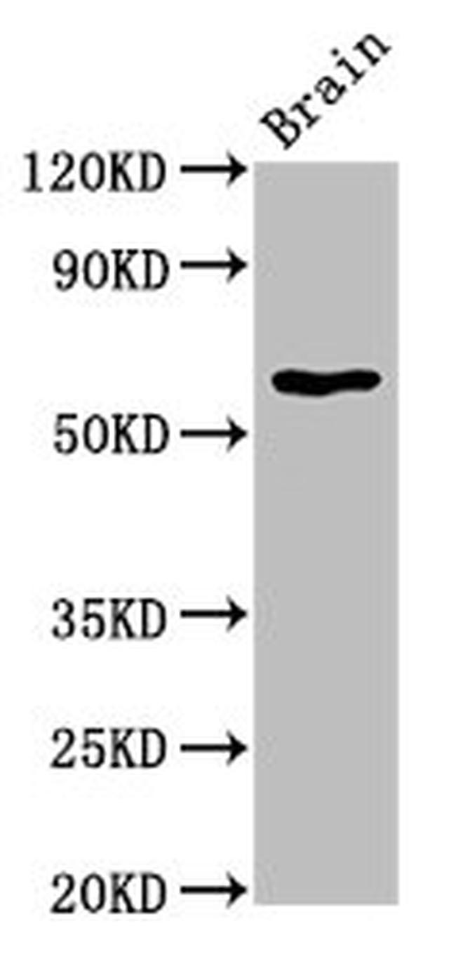 HEXA Antibody in Western Blot (WB)