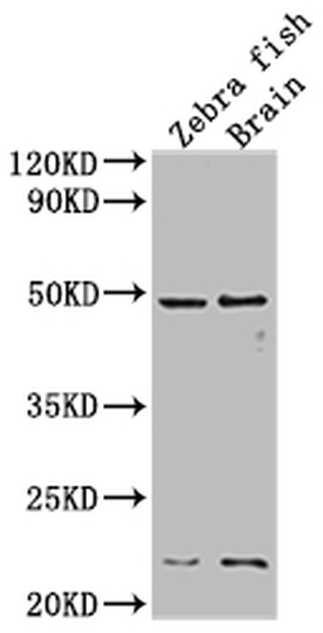 EGFR Antibody in Western Blot (WB)