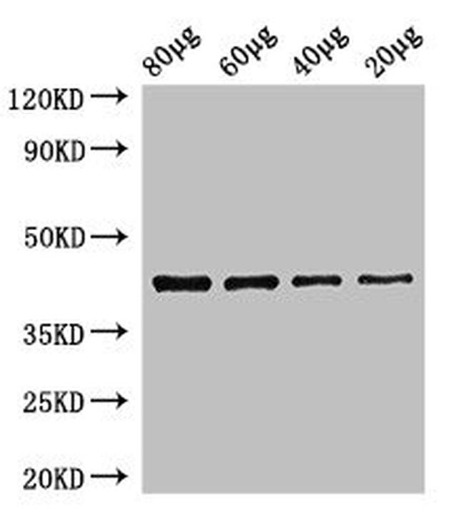 EGFR Antibody in Western Blot (WB)