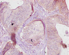 CES1 Antibody in Immunohistochemistry (Paraffin) (IHC (P))