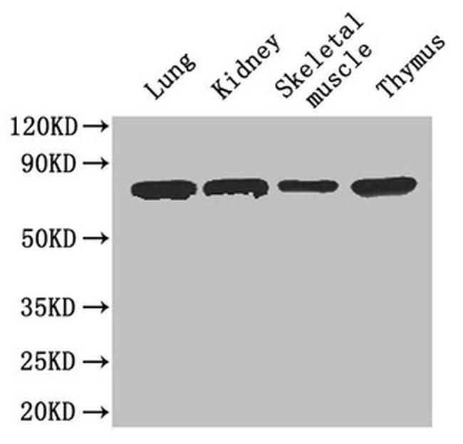 CES1 Antibody in Western Blot (WB)