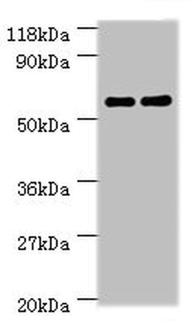 CES1 Antibody in Western Blot (WB)