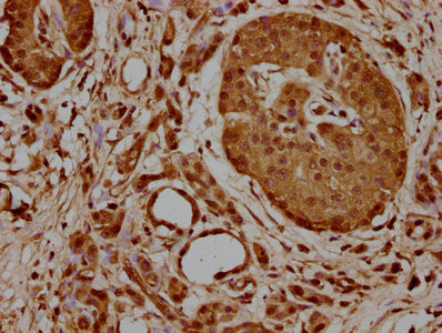 HSPA1A Antibody in Immunohistochemistry (Paraffin) (IHC (P))