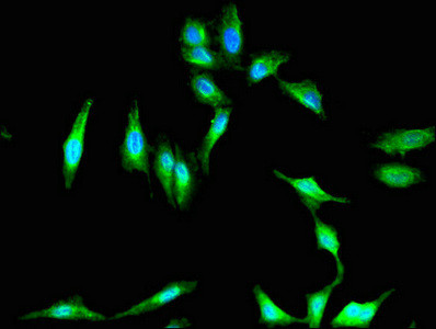 PKHD1 Antibody in Immunocytochemistry (ICC/IF)