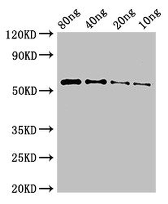 PKHD1 Antibody in Western Blot (WB)