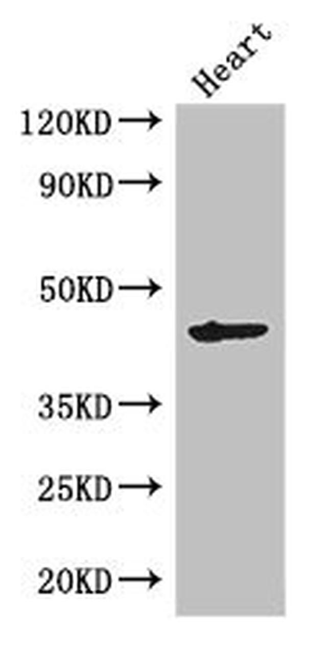 MEI4 Antibody in Western Blot (WB)