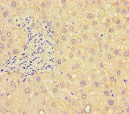 B4GALT5 Antibody in Immunohistochemistry (Paraffin) (IHC (P))