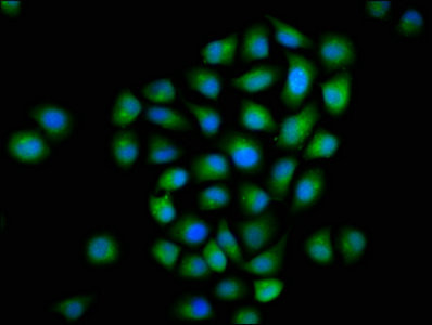 MTMR2 Antibody in Immunocytochemistry (ICC/IF)